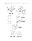 Intra-Vaginal Devices And Methods For Treating Fecal Incontinence diagram and image