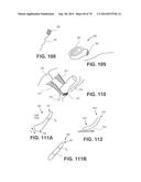 Intra-Vaginal Devices And Methods For Treating Fecal Incontinence diagram and image