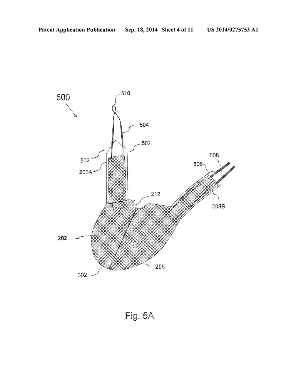 MEDICAL DEVICE FOR PELVIC FLOOR REPAIR AND METHOD OF DELIVERING THE     MEDICAL DEVICE - diagram, schematic, and image 05