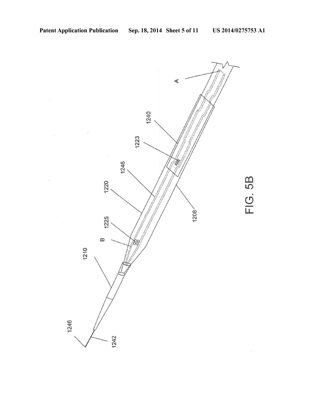 MEDICAL DEVICE FOR PELVIC FLOOR REPAIR AND METHOD OF DELIVERING THE     MEDICAL DEVICE - diagram, schematic, and image 06