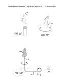 Devices, Systems and Methods for Treating Benign Prostatic Hyperplasia and     Other Conditions diagram and image