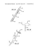 Devices, Systems and Methods for Treating Benign Prostatic Hyperplasia and     Other Conditions diagram and image