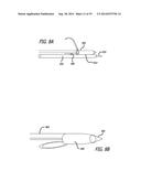 Devices, Systems and Methods for Treating Benign Prostatic Hyperplasia and     Other Conditions diagram and image