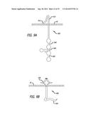 Devices, Systems and Methods for Treating Benign Prostatic Hyperplasia and     Other Conditions diagram and image