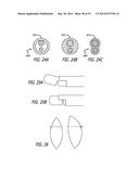 Devices, Systems and Methods for Treating Benign Prostatic Hyperplasia and     Other Conditions diagram and image