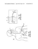 PARTIALLY DISPOSABLE ENDOSCOPIC DEVICE diagram and image