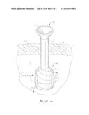 Thoracic Scope With Skirt And Gap diagram and image