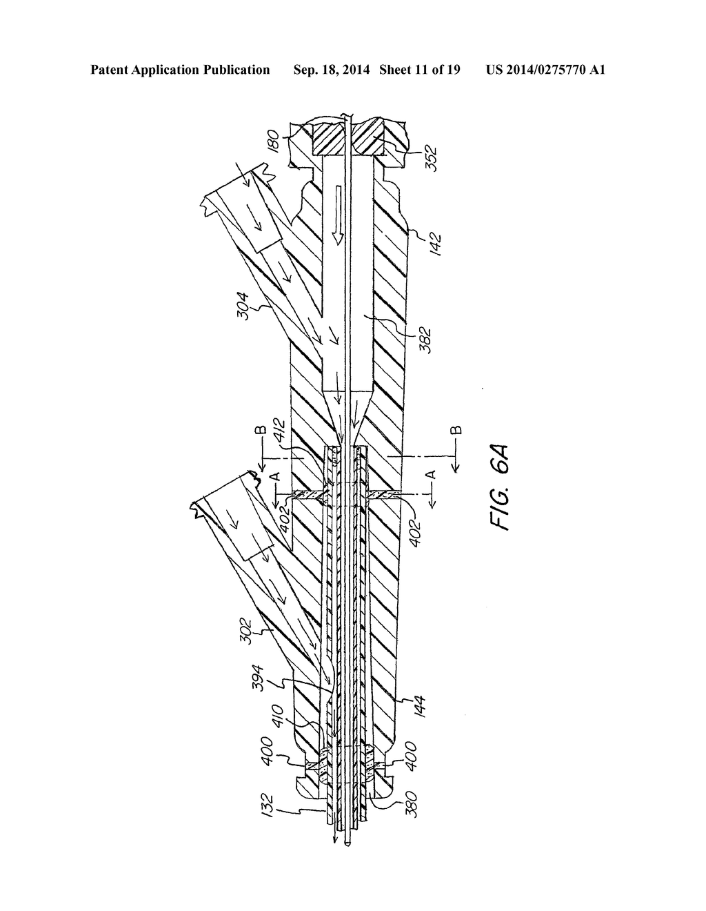 Handheld Resector Balloon System - diagram, schematic, and image 12