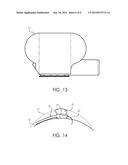 Delivery Catheter diagram and image