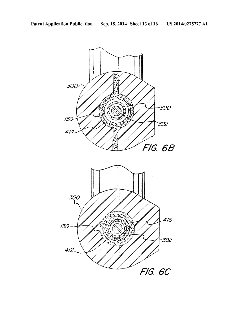 Resector Balloon Catheter With Multi-Port Hub - diagram, schematic, and image 14