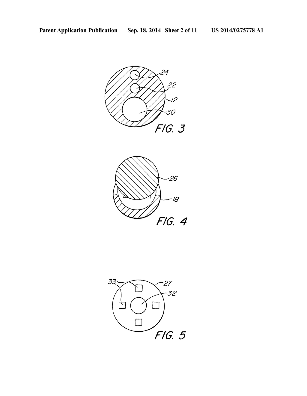 Imaging Stylet for Intubation - diagram, schematic, and image 03