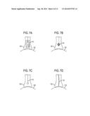 SURGICAL RETRACTORS diagram and image