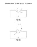 CONTROL OF A DEFIBRILLATOR AND/OR PACEMAKER diagram and image