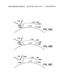 WEARABLE BODY MONITOR DEVICE WITH A FLEXIBLE SECTION AND SENSOR THEREIN diagram and image