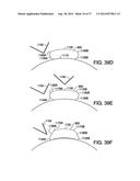 WEARABLE BODY MONITOR DEVICE WITH A FLEXIBLE SECTION AND SENSOR THEREIN diagram and image