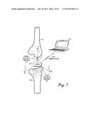 Muscular-Skeletal Joint Stability Detection and Method Therefor diagram and image