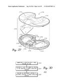 Muscular-Skeletal Joint Stability Detection and Method Therefor diagram and image