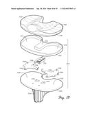 Muscular-Skeletal Joint Stability Detection and Method Therefor diagram and image