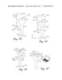 Muscular-Skeletal Joint Stability Detection and Method Therefor diagram and image