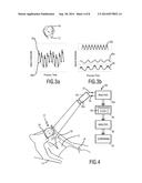 DEVICE AND METHOD FOR OBTAINING VITAL SIGN INFORMATION OF A SUBJECT diagram and image