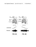 DEVICE TO MONITOR AND PROMOTE SUCCESSFUL ENDOTRACHEAL INTUBATION AND     VENTILATION diagram and image