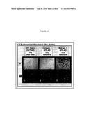 Coated Surgical Mesh, and Corresponding Systems and Methods diagram and image