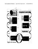 Coated Surgical Mesh, and Corresponding Systems and Methods diagram and image