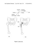 SYSTEM AND METHOD FOR INTRA-OPERATIVE LEG POSITION MEASUREMENT diagram and image