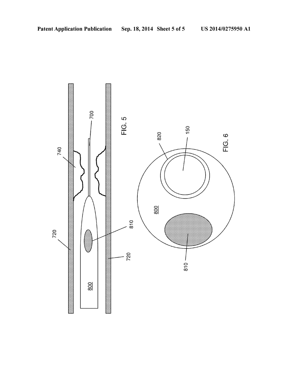 IMAGING GUIDEWIRE WITH PRESSURE SENSING - diagram, schematic, and image 06