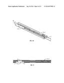 Side Lumen Reentry Catheters And Related Methods diagram and image