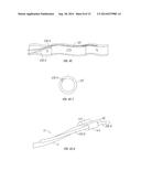 Side Lumen Reentry Catheters And Related Methods diagram and image