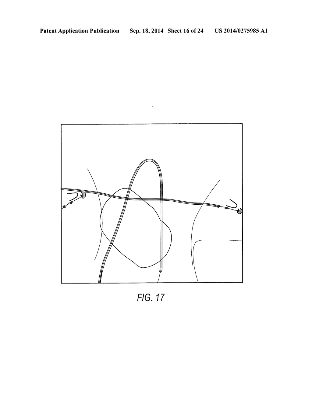 SYSTEMS AND METHODS FOR LOCALIZING, TRACKING AND/OR CONTROLLING MEDICAL     INSTRUMENTS - diagram, schematic, and image 17