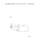 TISSUE IMAGING AND IMAGE GUIDANCE IN LUMINAL ANATOMIC STRUCTURES AND BODY     CAVITIES diagram and image