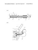 TISSUE IMAGING AND IMAGE GUIDANCE IN LUMINAL ANATOMIC STRUCTURES AND BODY     CAVITIES diagram and image