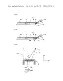 TISSUE IMAGING AND IMAGE GUIDANCE IN LUMINAL ANATOMIC STRUCTURES AND BODY     CAVITIES diagram and image