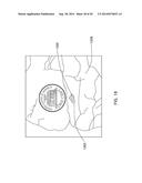 MICROWAVE ENERGY-DEVICE AND SYSTEM diagram and image