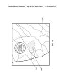 MICROWAVE ENERGY-DEVICE AND SYSTEM diagram and image