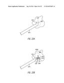 Device for Minimally Invasive Delivery of Treatment Substance diagram and image