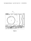 COREGISTERED INTRAVASCULAR AND ANGIOGRAPHIC IMAGES diagram and image