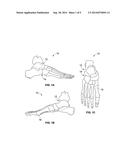 APPARATUS FOR OPTICAL SCANNING OF THE FOOT FOR ORTHOSIS diagram and image