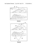 APPARATUS FOR OPTICAL SCANNING OF THE FOOT FOR ORTHOSIS diagram and image