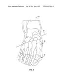 APPARATUS FOR OPTICAL SCANNING OF THE FOOT FOR ORTHOSIS diagram and image