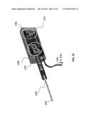 SCANNING TECHNIQUES FOR PROBING AND MEASURING ANATOMICAL CAVITIES diagram and image