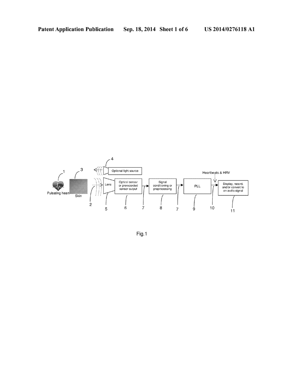 Method and System for Contactless Detection of Cardiac Activity - diagram, schematic, and image 02