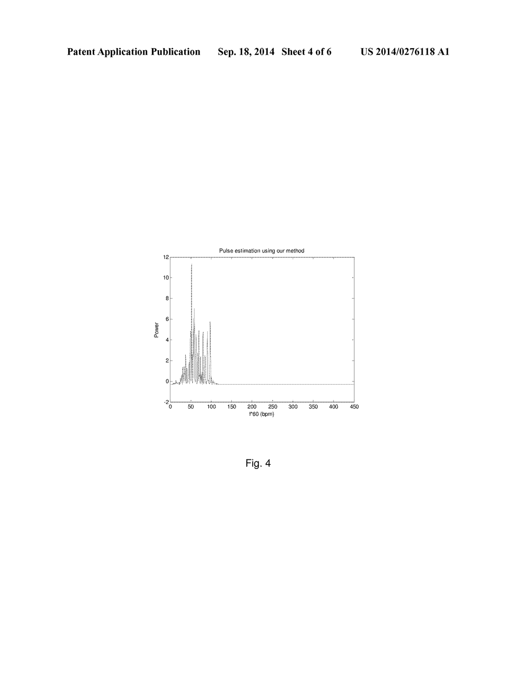 Method and System for Contactless Detection of Cardiac Activity - diagram, schematic, and image 05