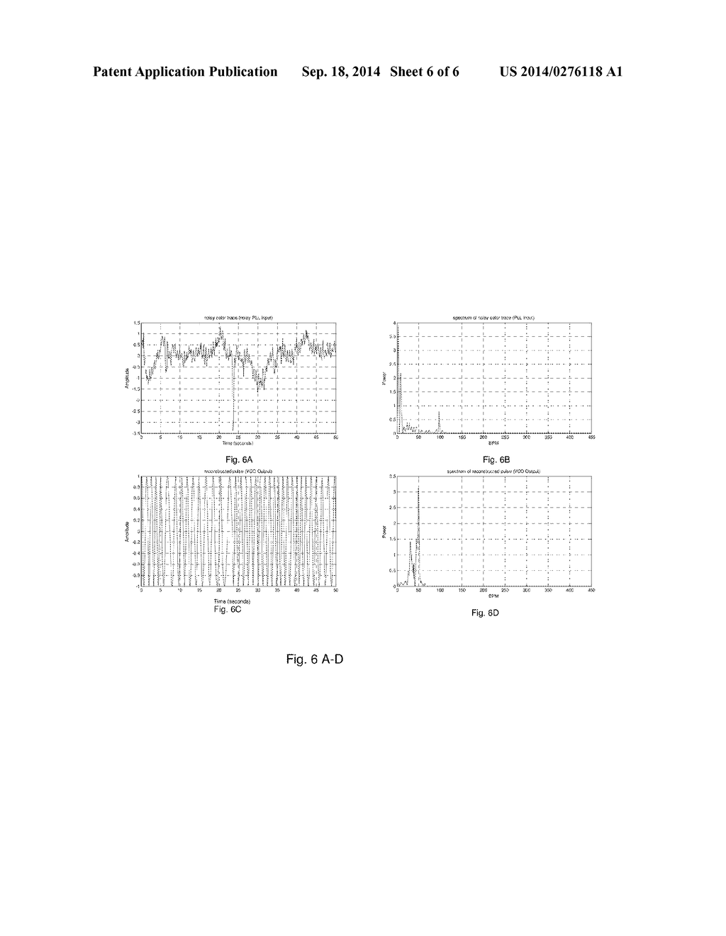 Method and System for Contactless Detection of Cardiac Activity - diagram, schematic, and image 07