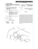 SYSTEM AND METHOD FOR AVOIDING UNDERSENSING OF VENTRICULAR FIBRILLATION diagram and image