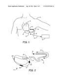 SYSTEM AND METHOD FOR AVOIDING UNDERSENSING OF VENTRICULAR FIBRILLATION diagram and image