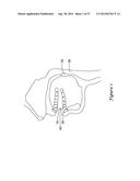 MEDICAL BREATHING APPARATUS diagram and image