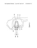 MEDICAL BREATHING APPARATUS diagram and image